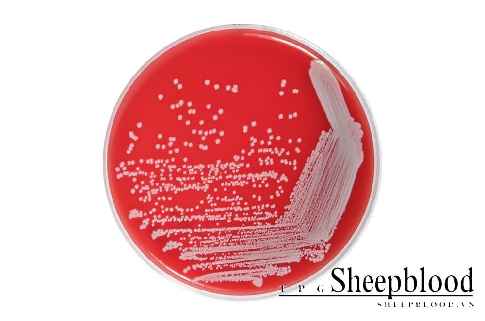 Columbia Agar +5% Sheep Blood